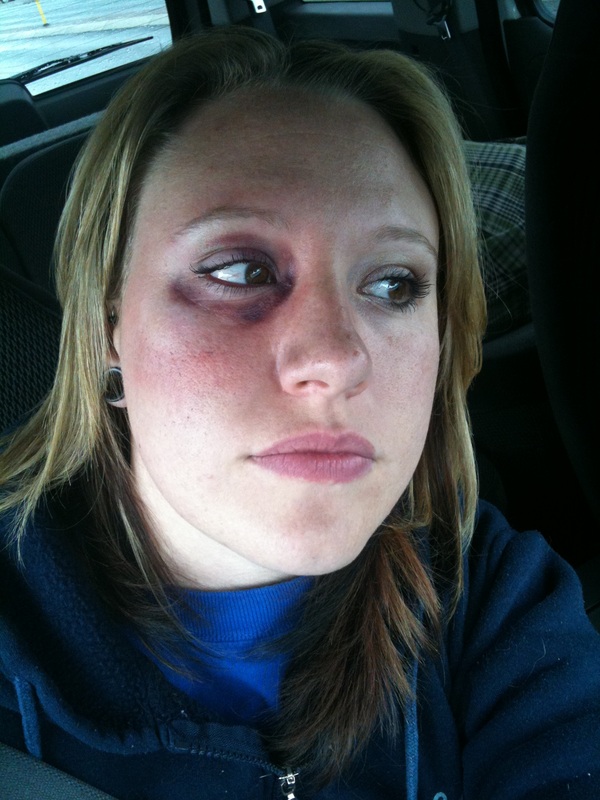 Injury Simulation Disaster Training - Perspectives Makeup Injury Simulation Disaster Training - Perspectives Makeup